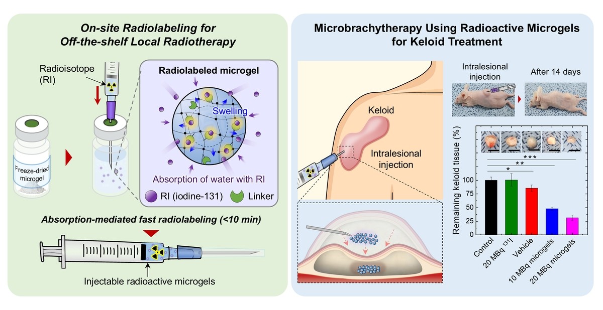 Une équipe sud-coréenne développe une technologie de radiothérapie locale par microgels biodégradables
